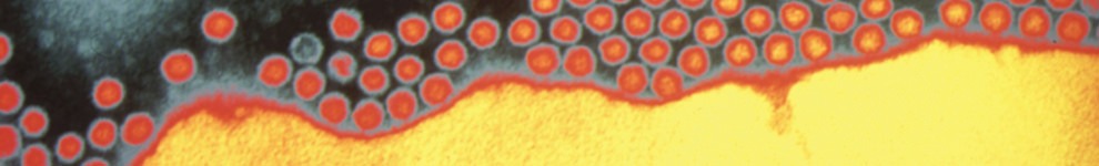 Electron microscope image of the Poliovirus