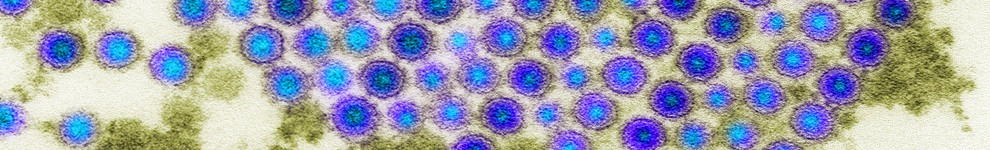 Electron microscope image of the chikungunya virus.