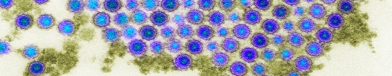 Electron microscope image of the chikungunya virus.