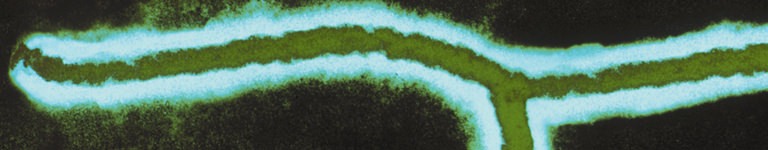 Electron microscope image of the ebola virus
