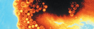 Electron microscope image of the Hepatits A virus