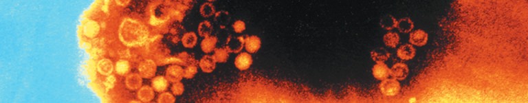 Electron microscope image of the Hepatits A virus