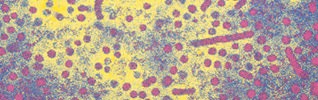 Electron microscope image of the Hepatits B virus