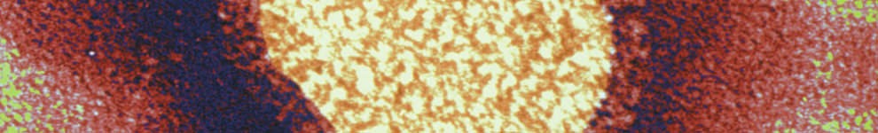 Electron microscope image of the Influenza virus