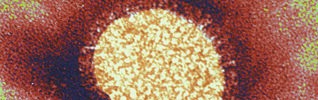 Electron microscope image of the Influenza virus