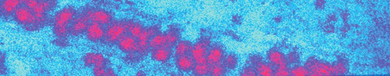 Electron microscope image of the Japanese Encephalitis virus