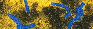 Electron microscope image of the Mumps virus