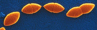 Electron microscope image of the streptococcus pneumoniae bacterium