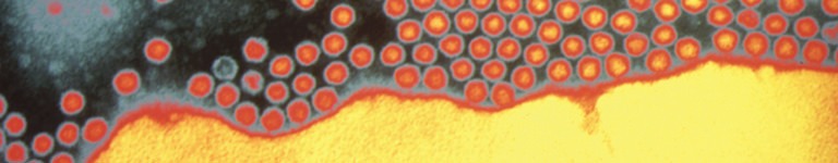 Electron microscope image of the Poliovirus