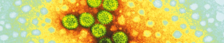 Electron microscope image of the Rotavirus