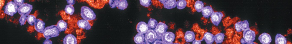 Electron microscope image of the Rubella virus