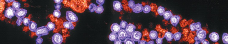 Electron microscope image of the Rubella virus