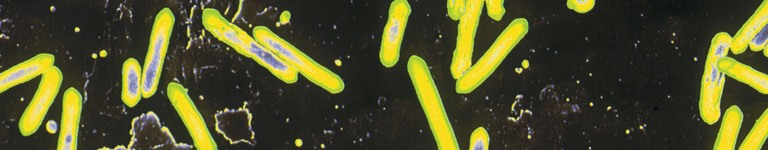 Electron microscope image of the Clostridium tetani bacterium