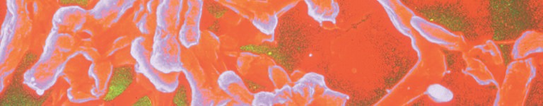 Electron microscope image of the Salmonella Typhi bacterium