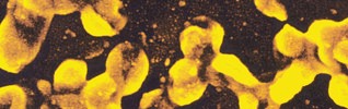 Electron microscope image of the Bordatella Pertussis bacterium