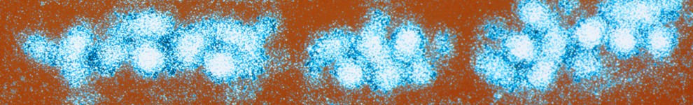 Electron microscope image of the Yellow Fever virus